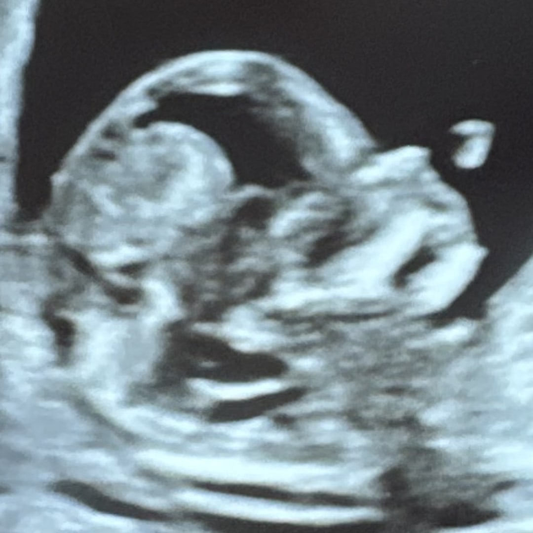 Photo shared by Amanda for their Babylist baby registry.