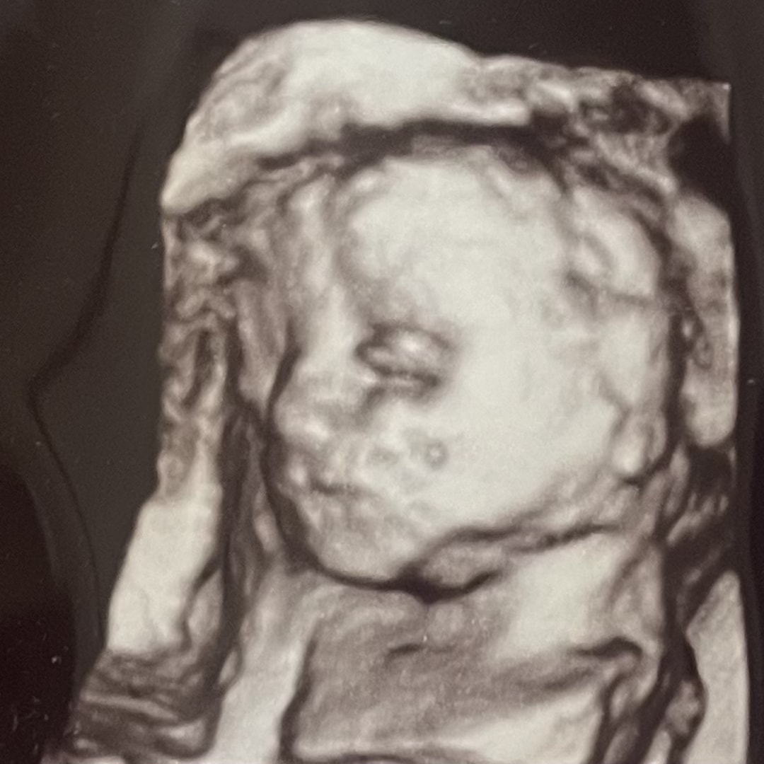 Photo shared by Baleigh for their Babylist baby registry.