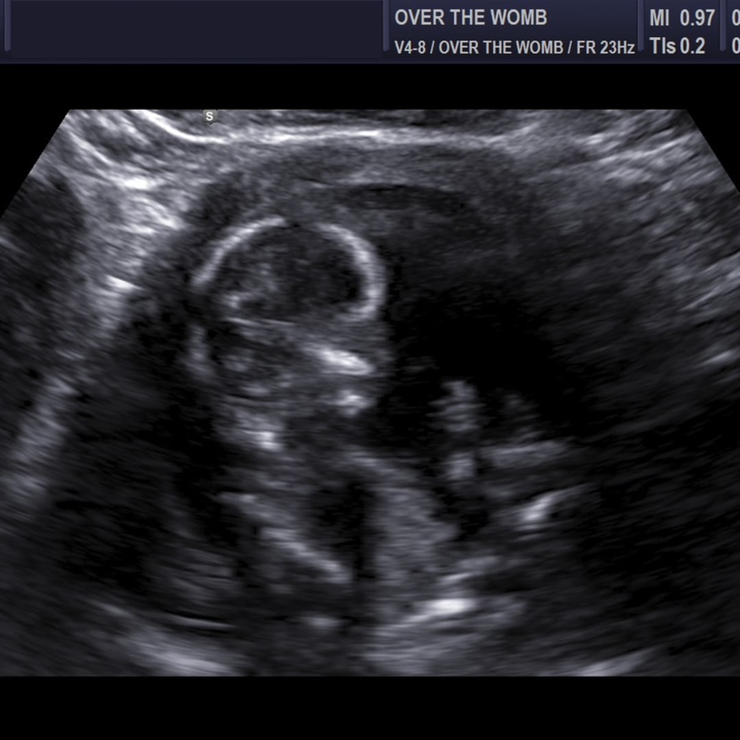 Photo shared by Brenna for their Babylist baby registry.