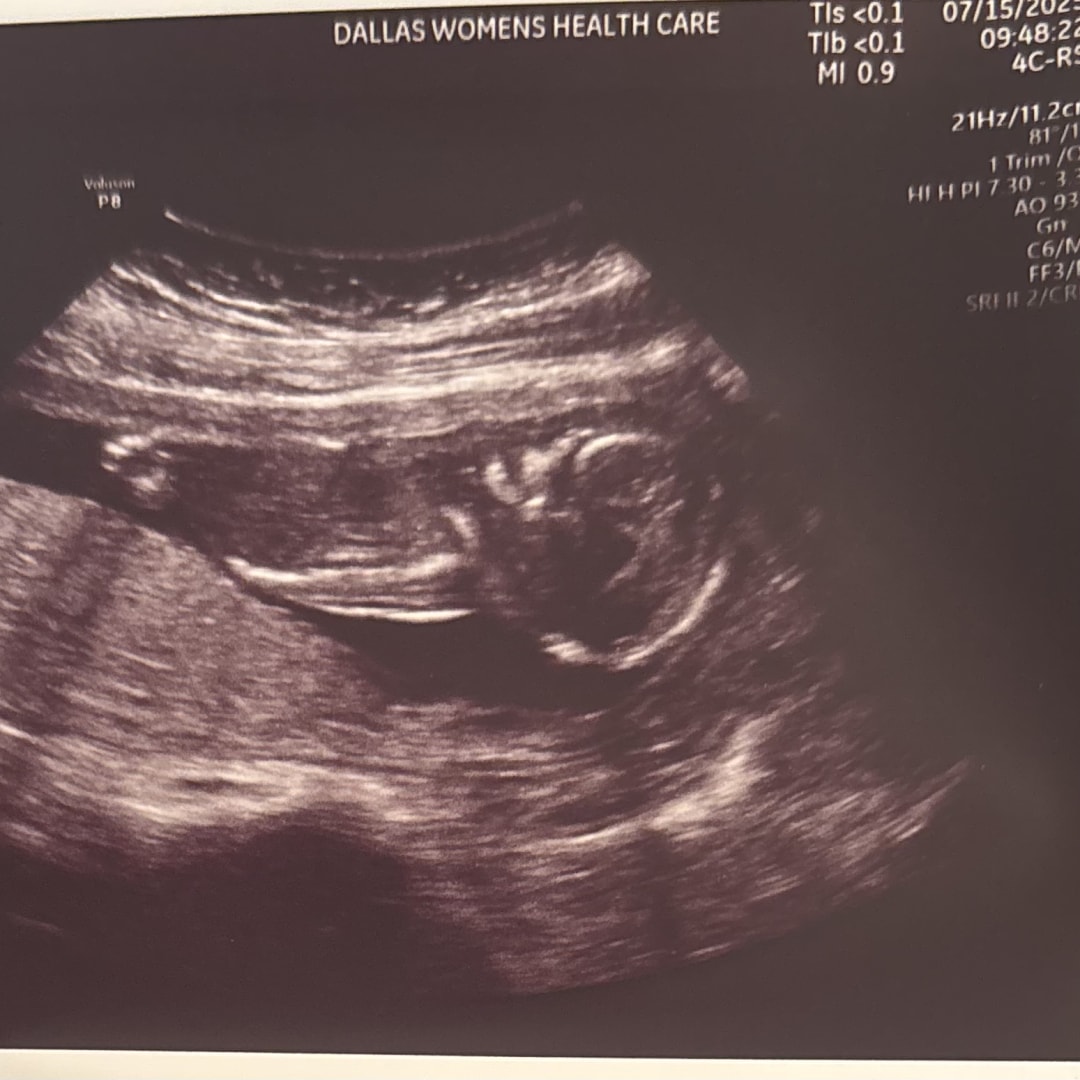 Photo shared by Edna for their Babylist baby registry.