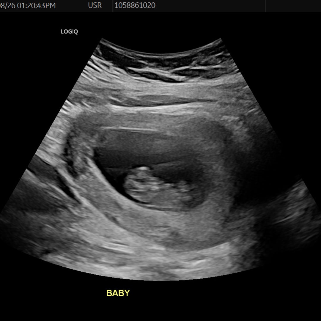 Photo shared by Cierra for their Babylist baby registry.