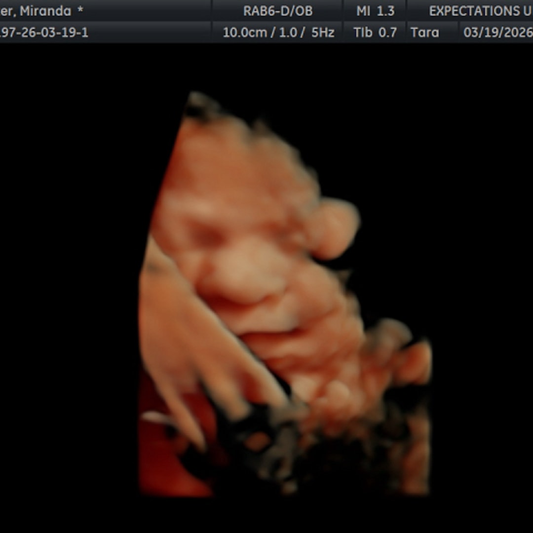 Photo shared by Miranda for their Babylist baby registry.