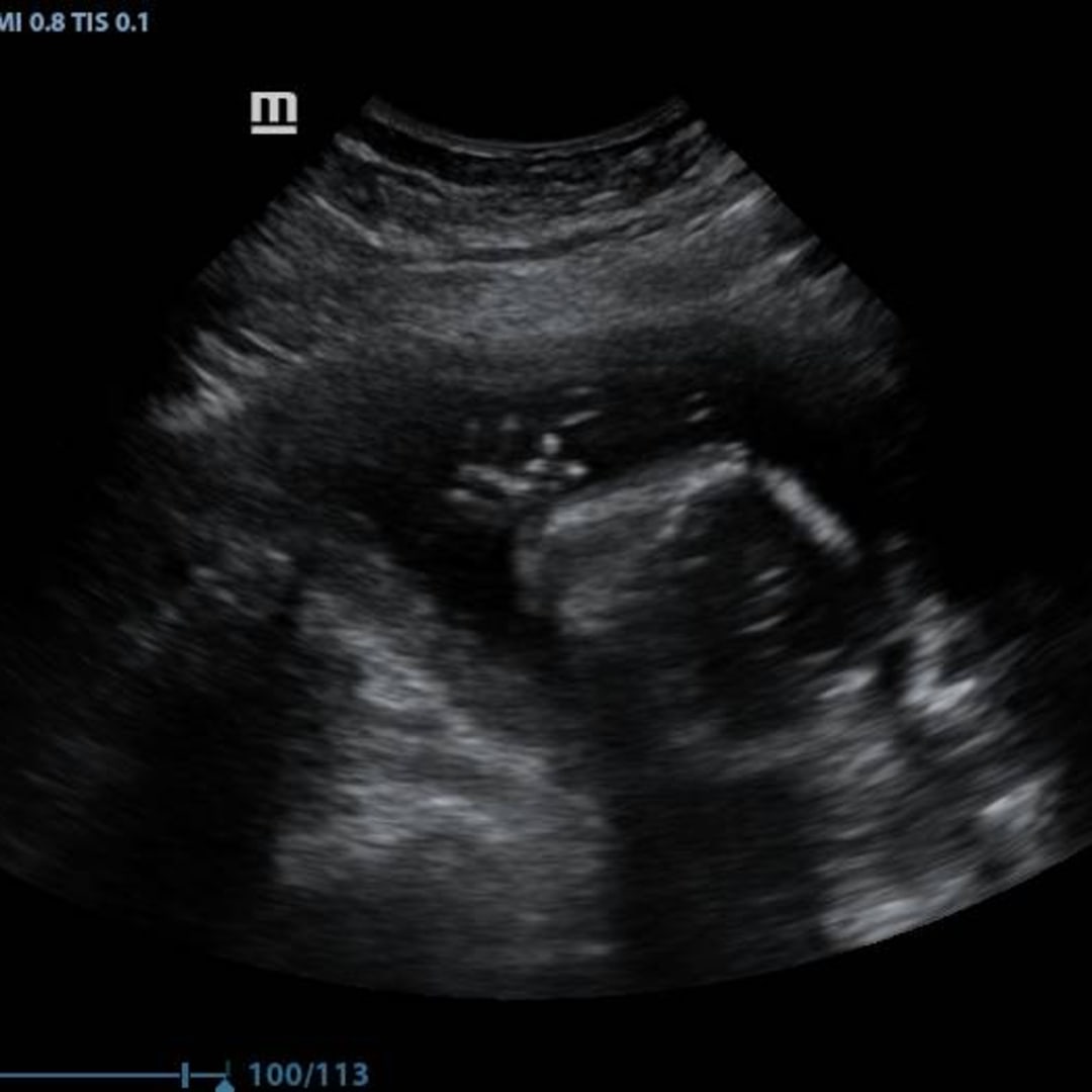 Photo shared by Leigha for their Babylist baby registry.