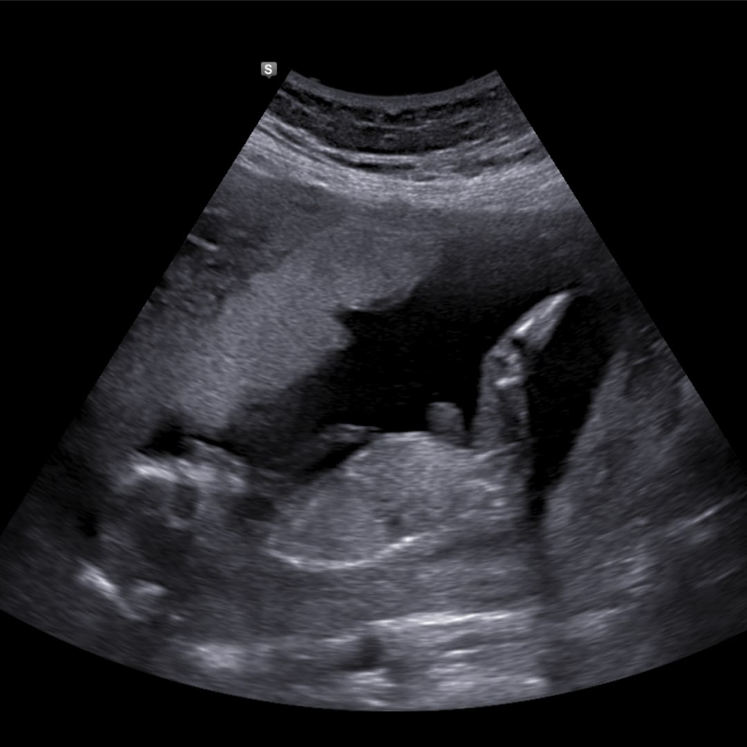 Photo shared by Paige for their Babylist baby registry.