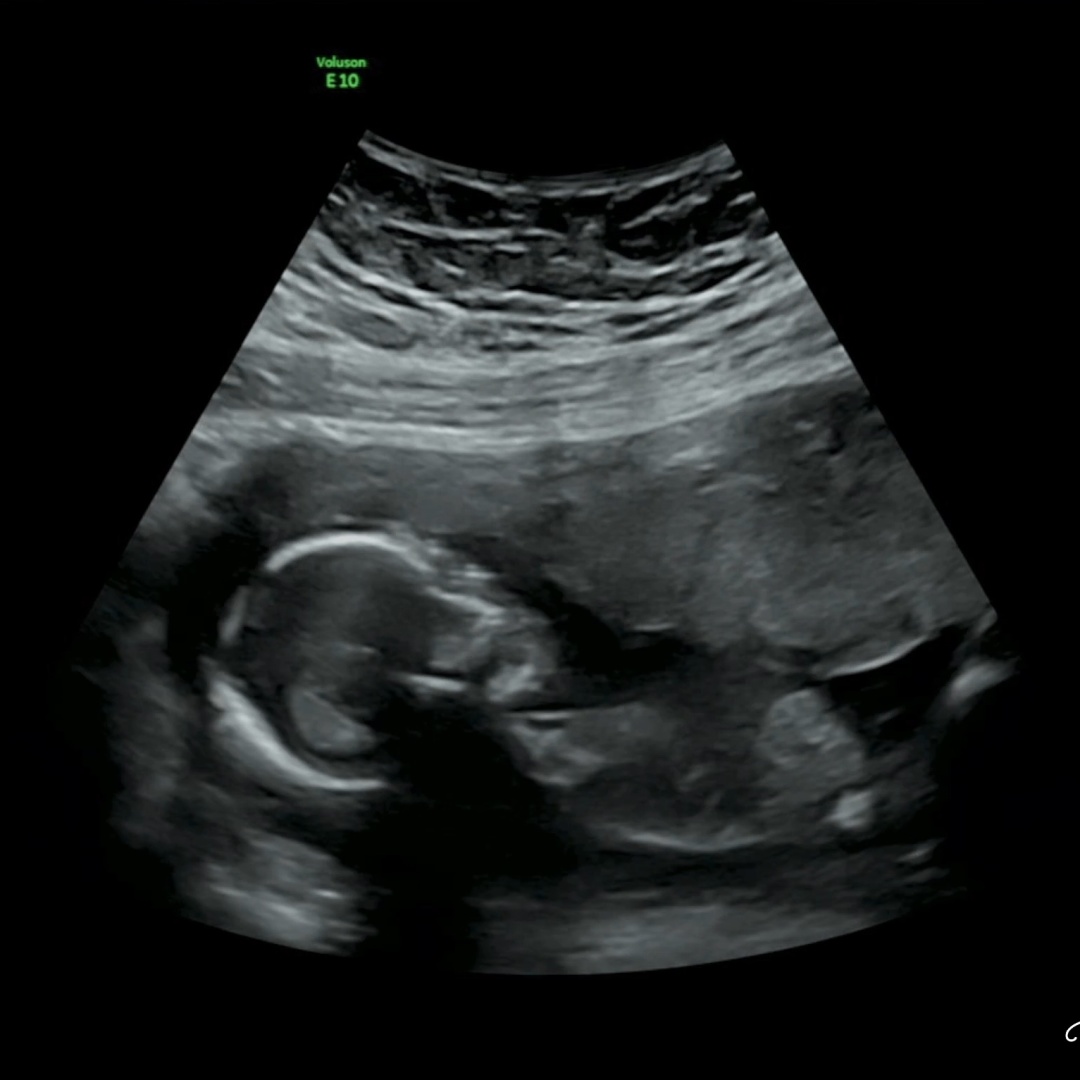 Photo shared by Summer for their Babylist baby registry.