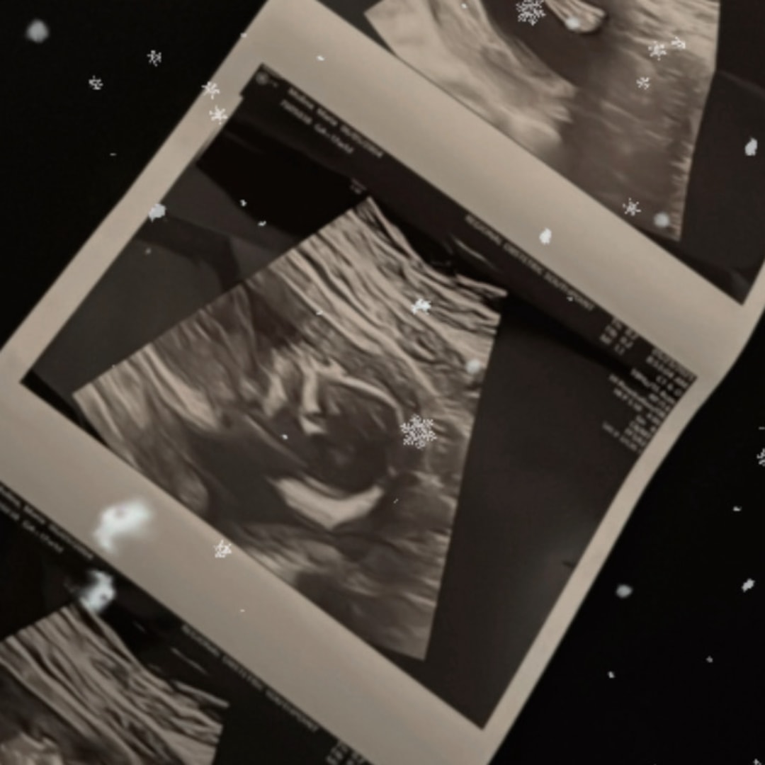 Photo shared by KeeAndre for their Babylist baby registry.
