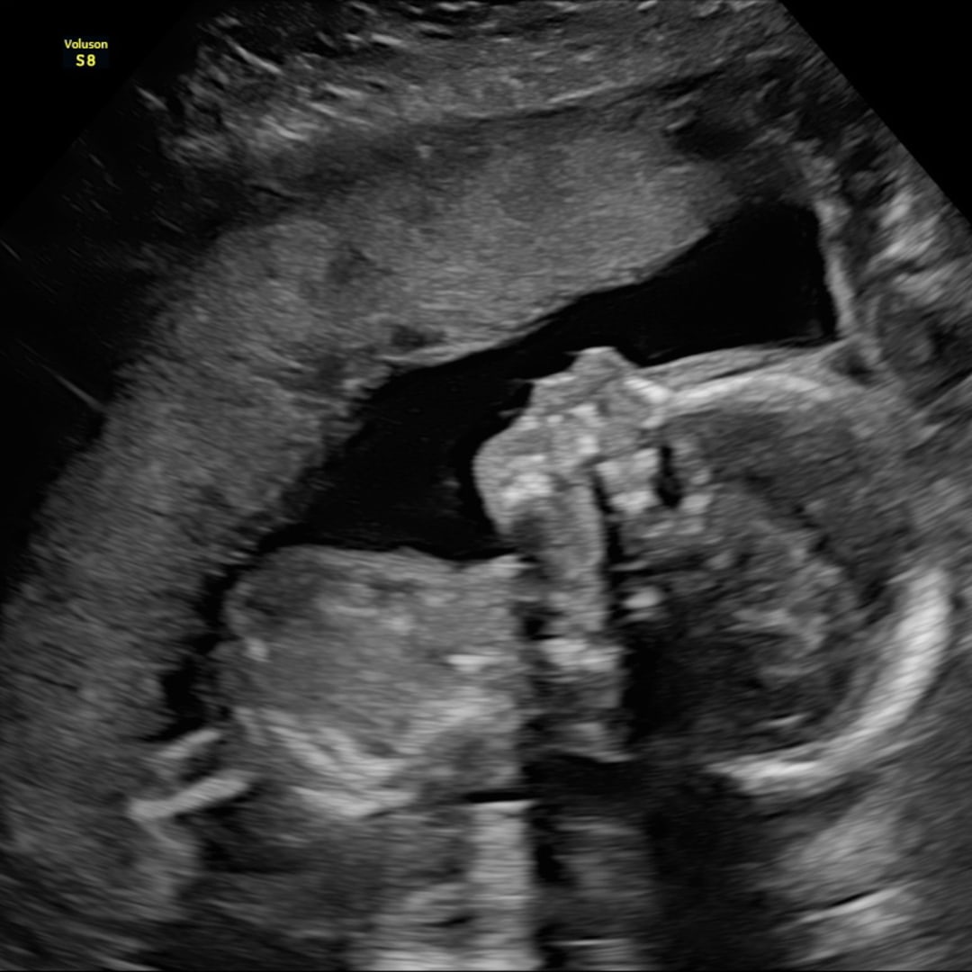 Photo shared by Aubrey for their Babylist baby registry.