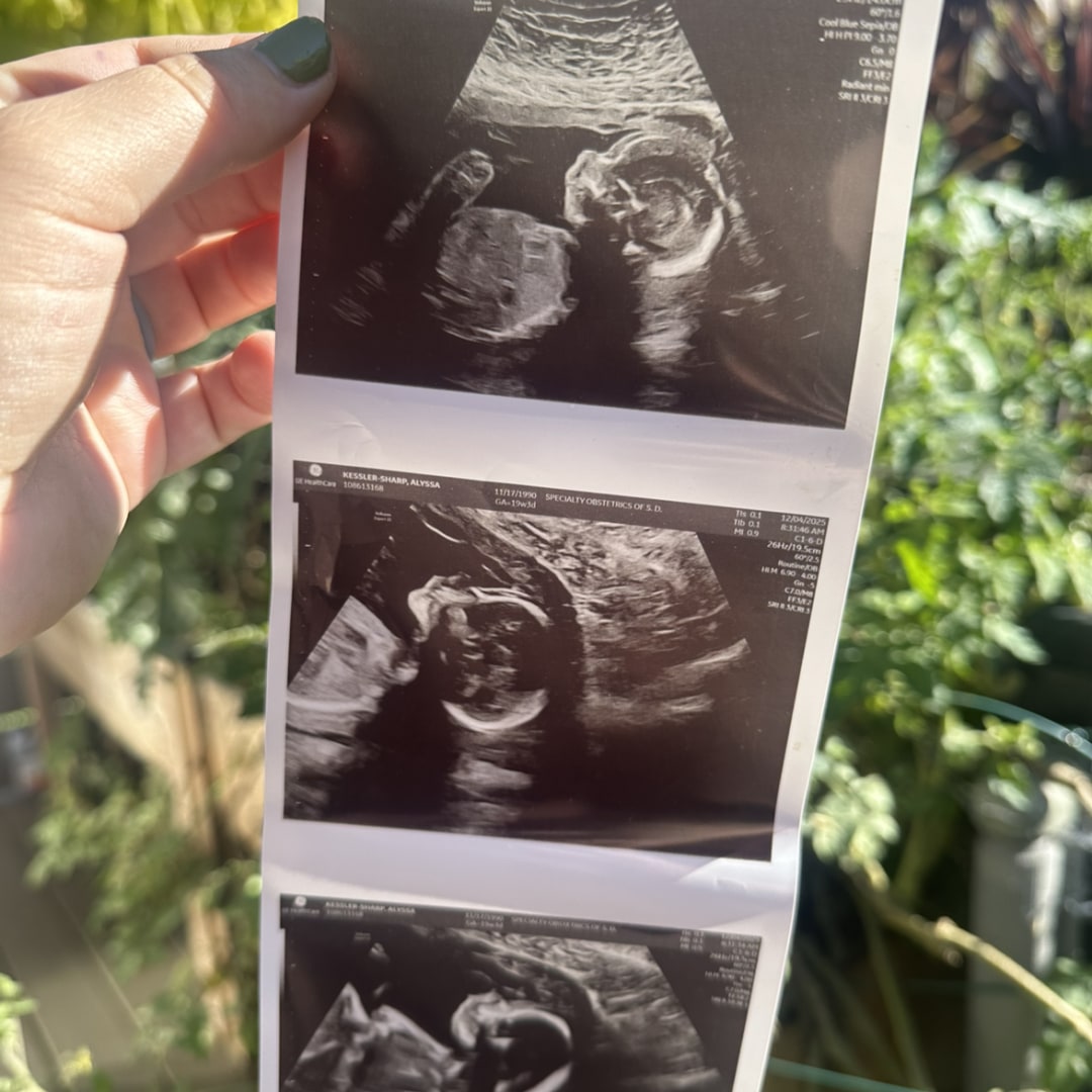 Photo shared by Alyssa for their Babylist baby registry.