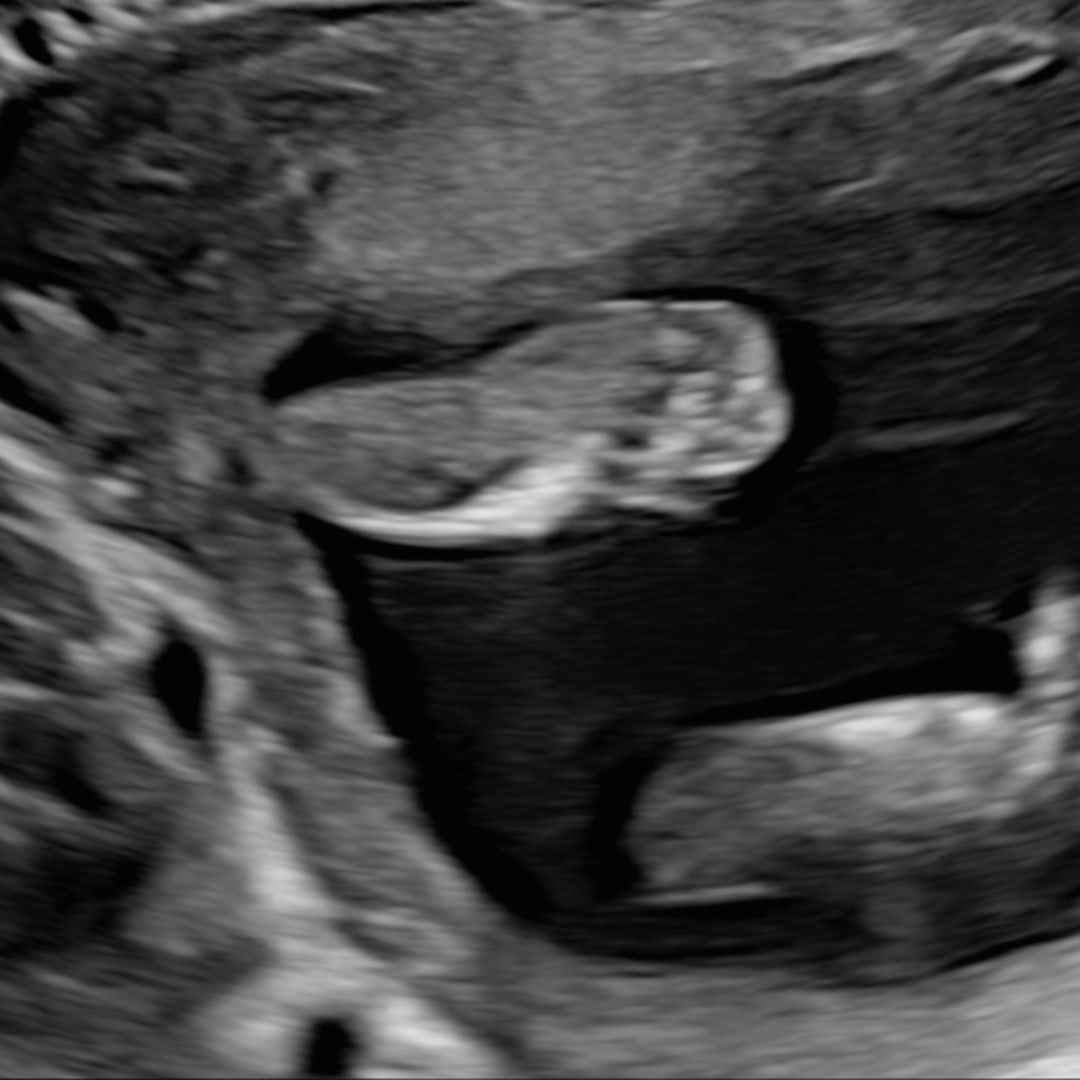 Photo shared by Ileana for their Babylist baby registry.