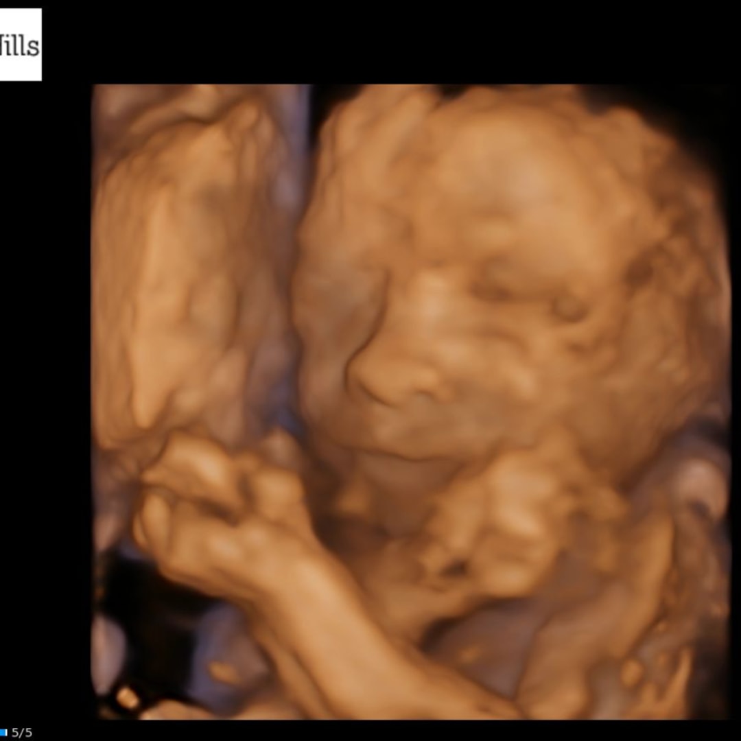 Photo shared by Paige for their Babylist baby registry.