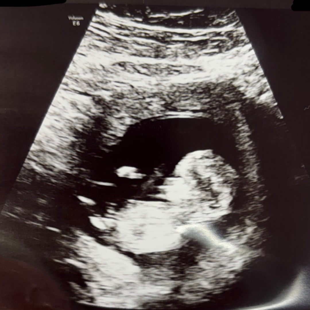 Photo shared by Jack for their Babylist baby registry.