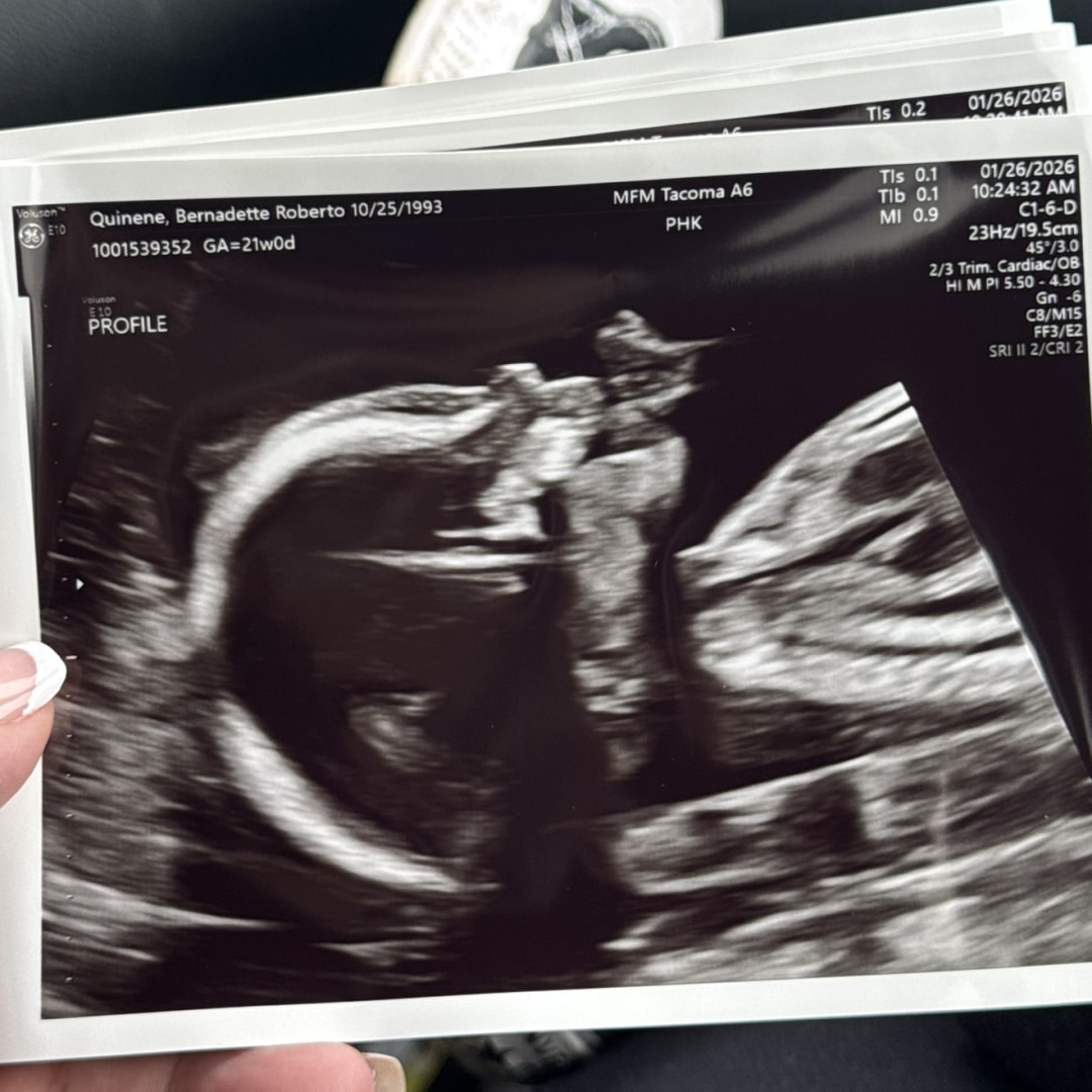 Photo shared by Bernadette for their Babylist baby registry.