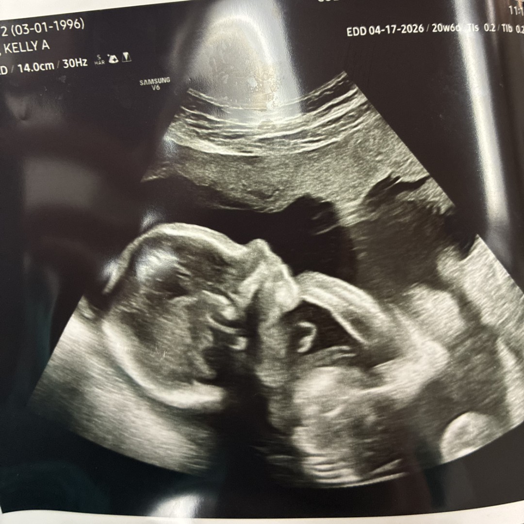 Photo shared by Kelly for their Babylist baby registry.