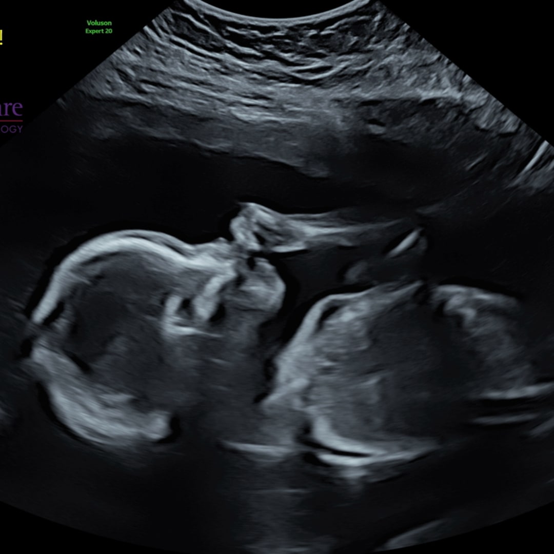 Photo shared by Sky for their Babylist baby registry.