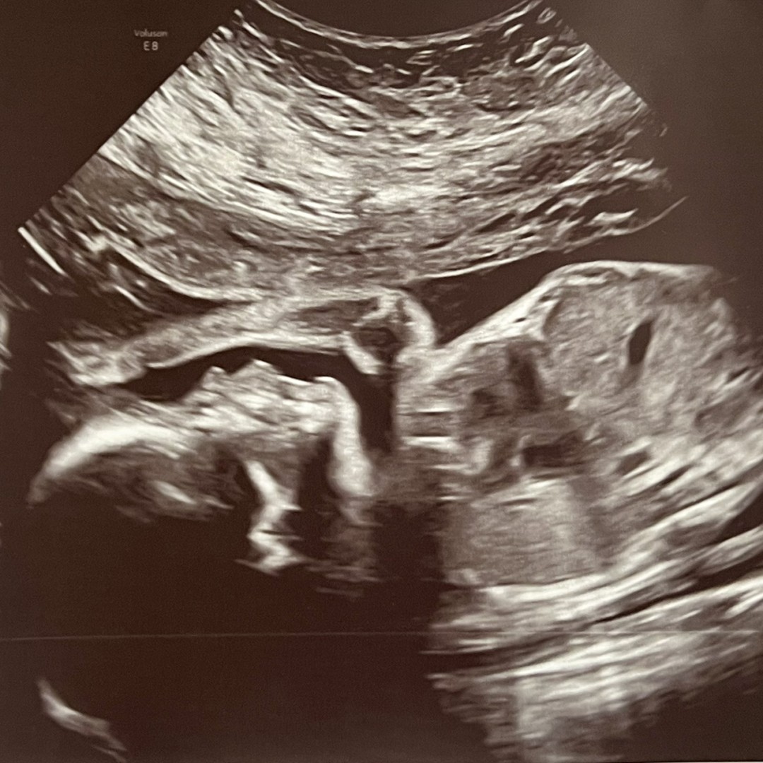 Photo shared by Erienne for their Babylist baby registry.