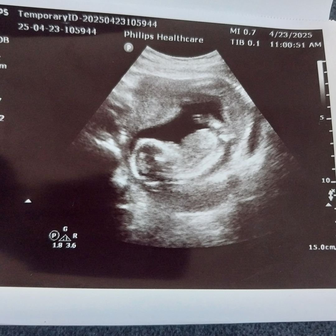Photo shared by Dynesha for their Babylist baby registry.