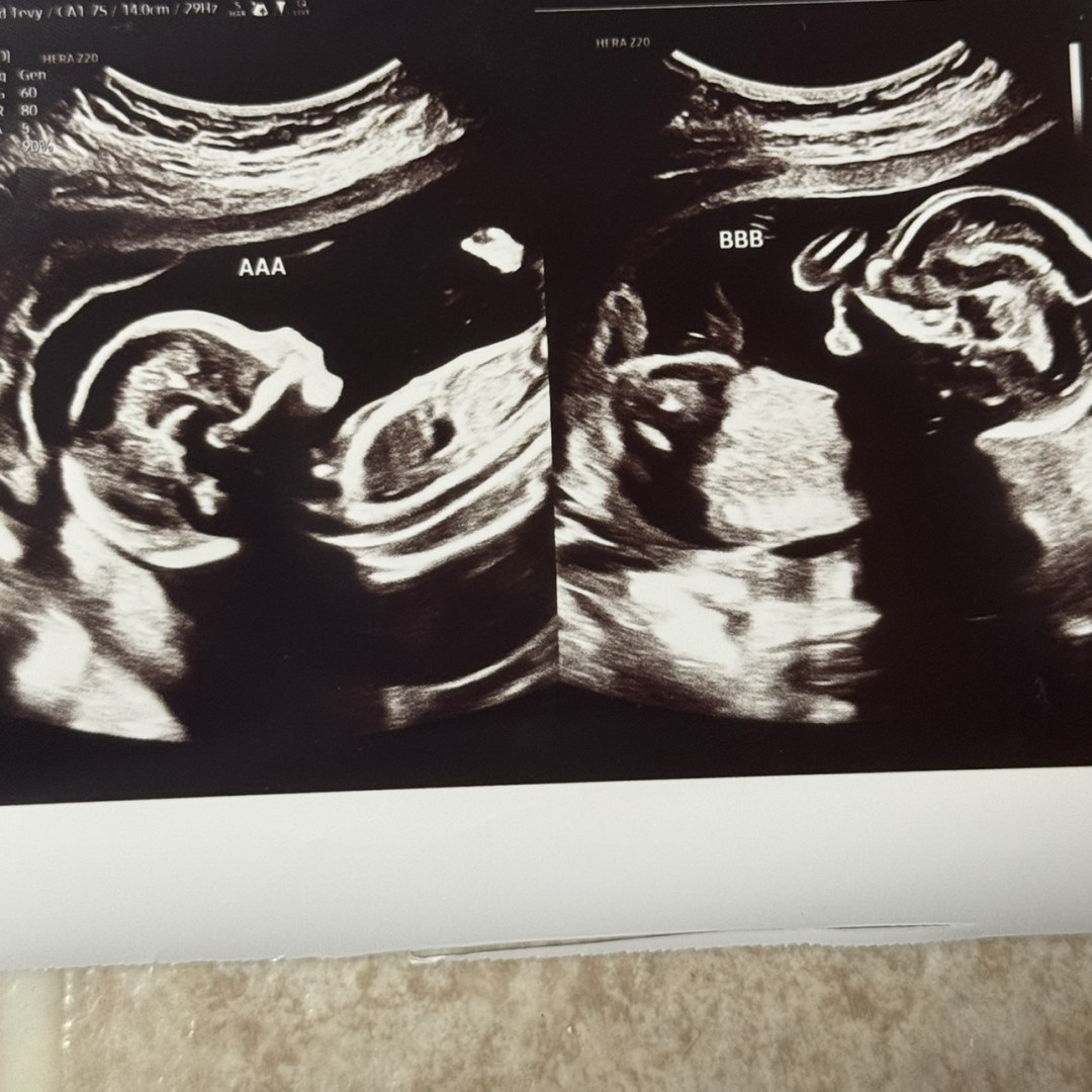 Photo shared by Ashley for their Babylist baby registry.