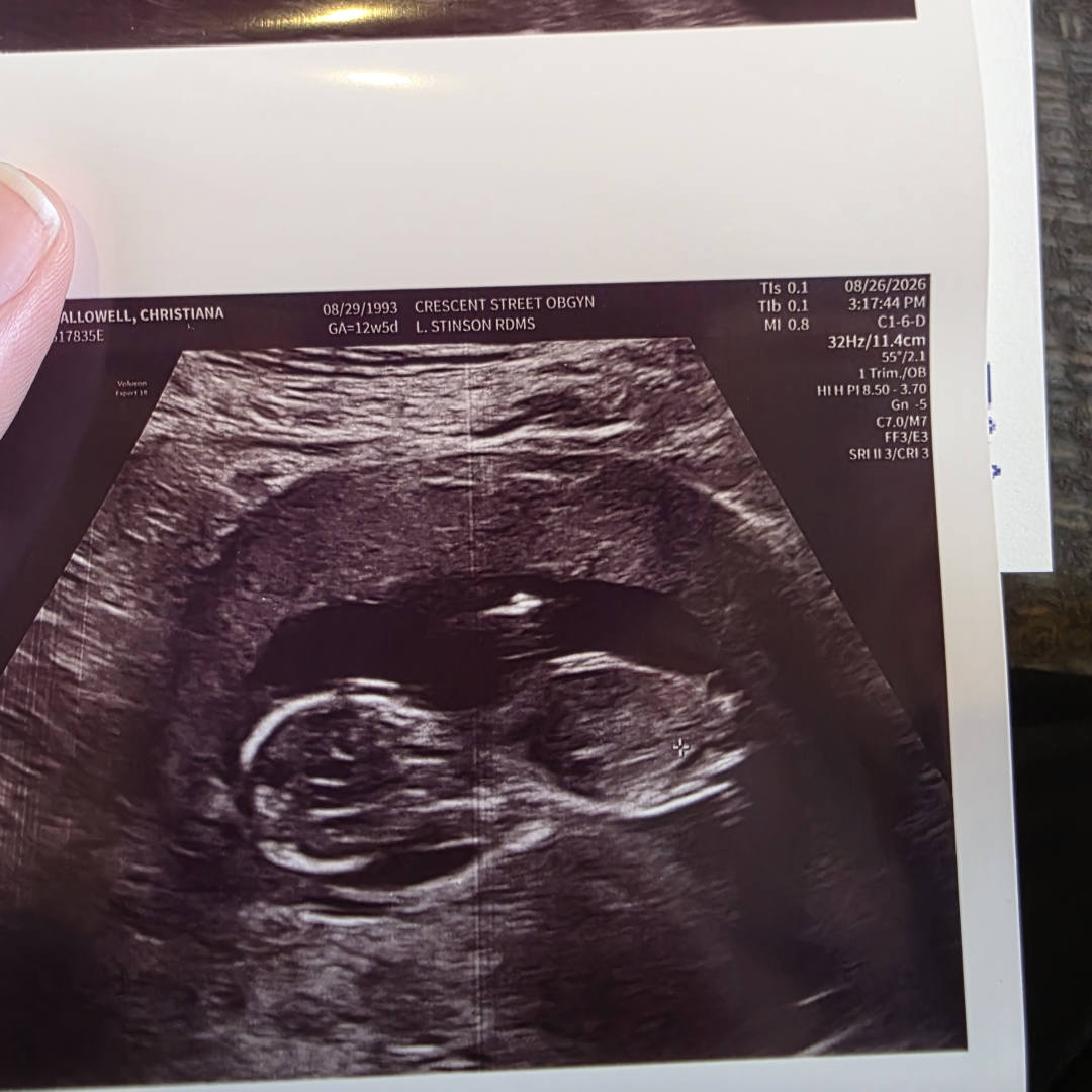 Photo shared by Chris for their Babylist baby registry.