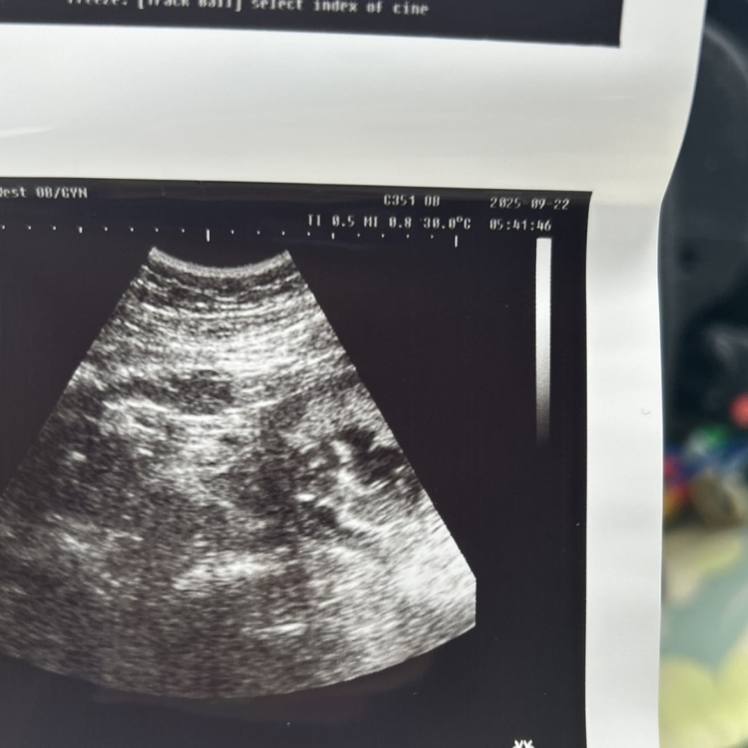 Photo shared by Kelsee for their Babylist baby registry.