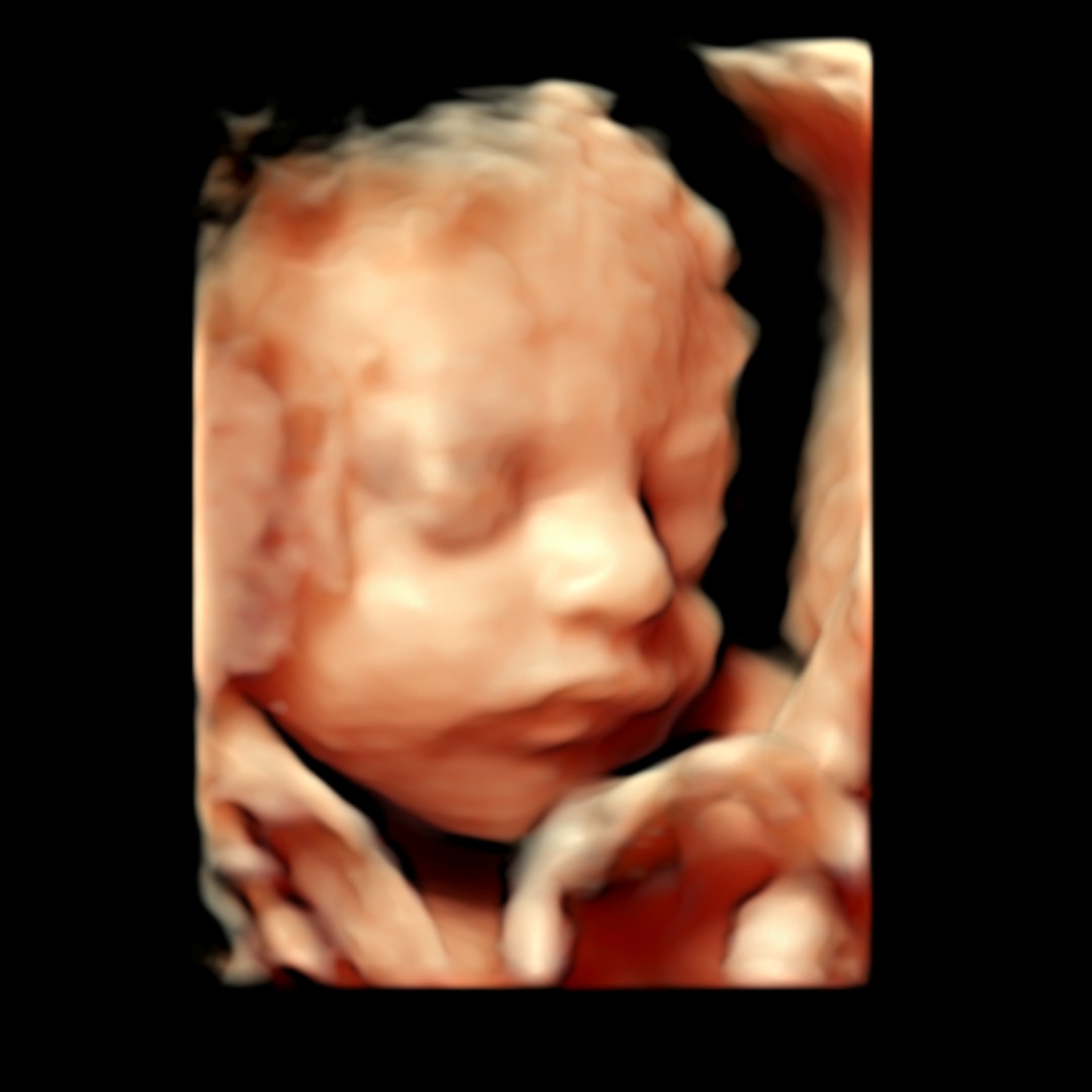 Photo shared by Sydney for their Babylist baby registry.