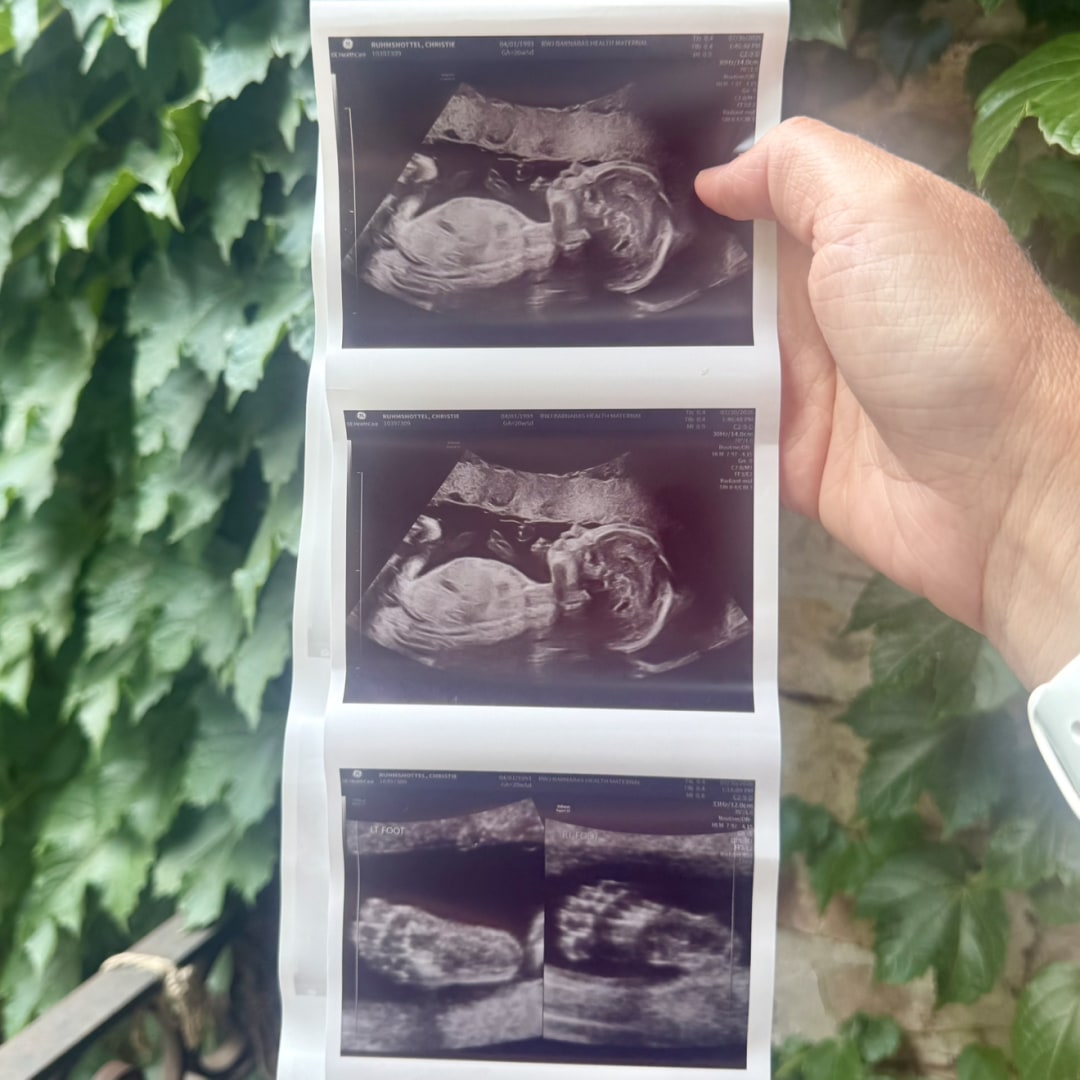 Photo shared by Christie for their Babylist baby registry.