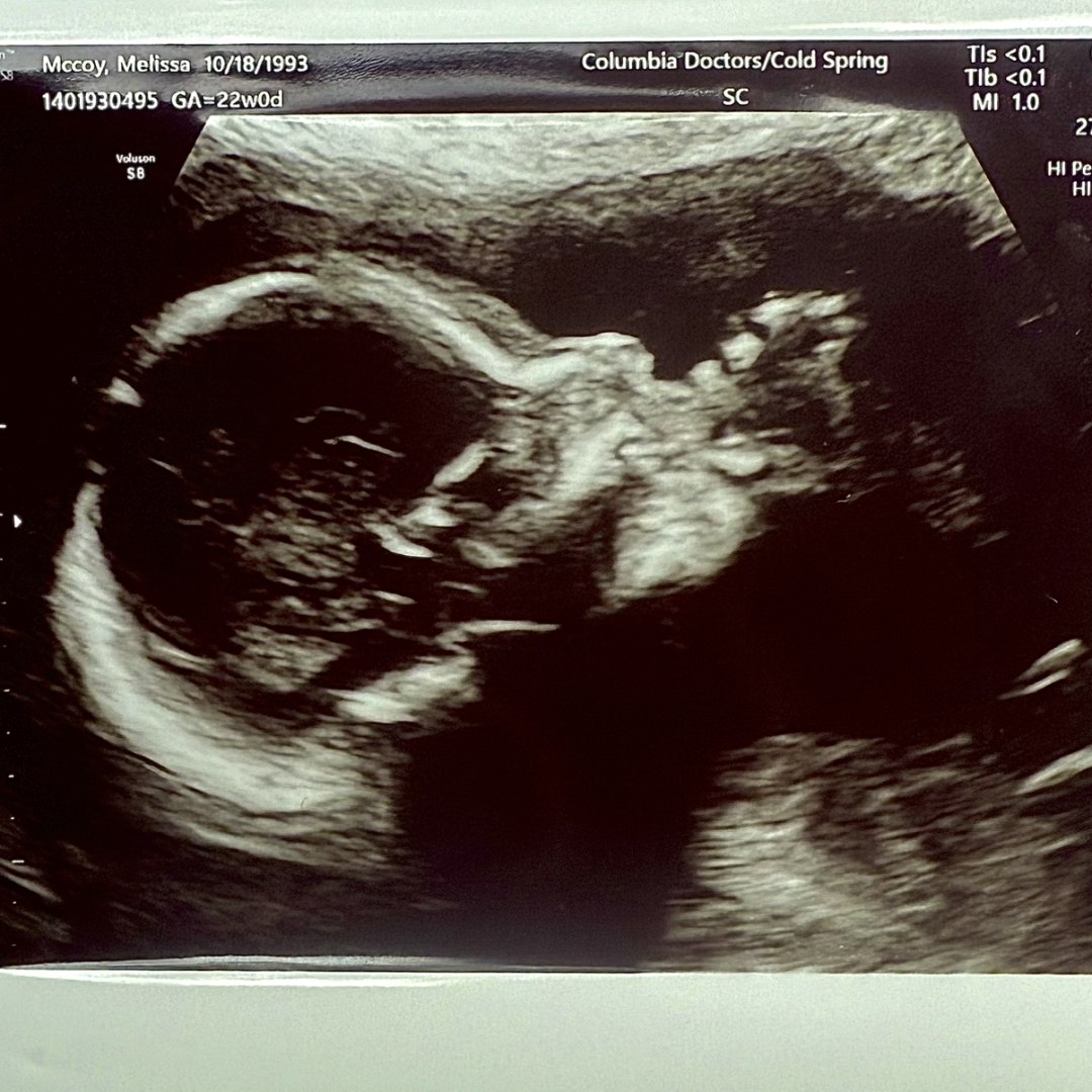 Photo shared by Melissa for their Babylist baby registry.