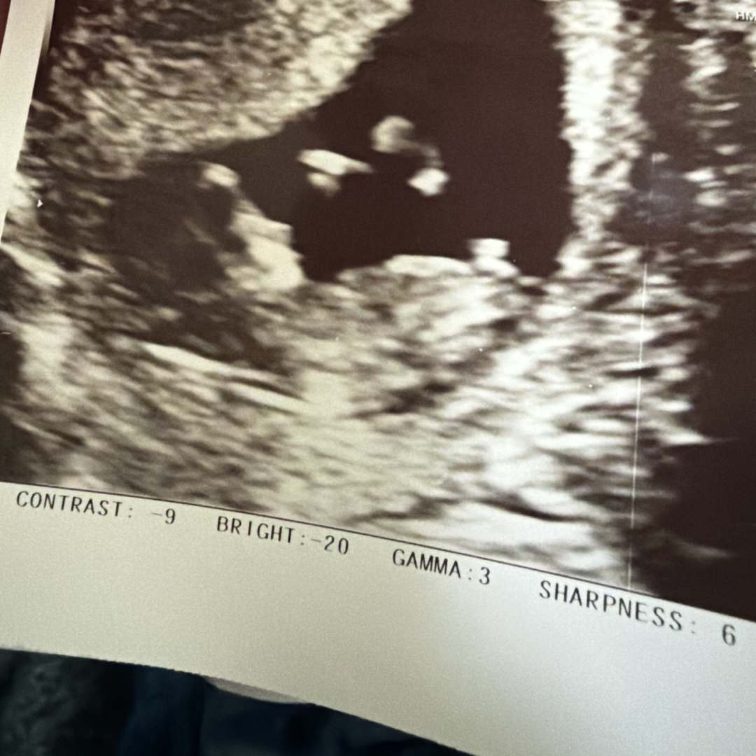 Photo shared by Nicole for their Babylist baby registry.