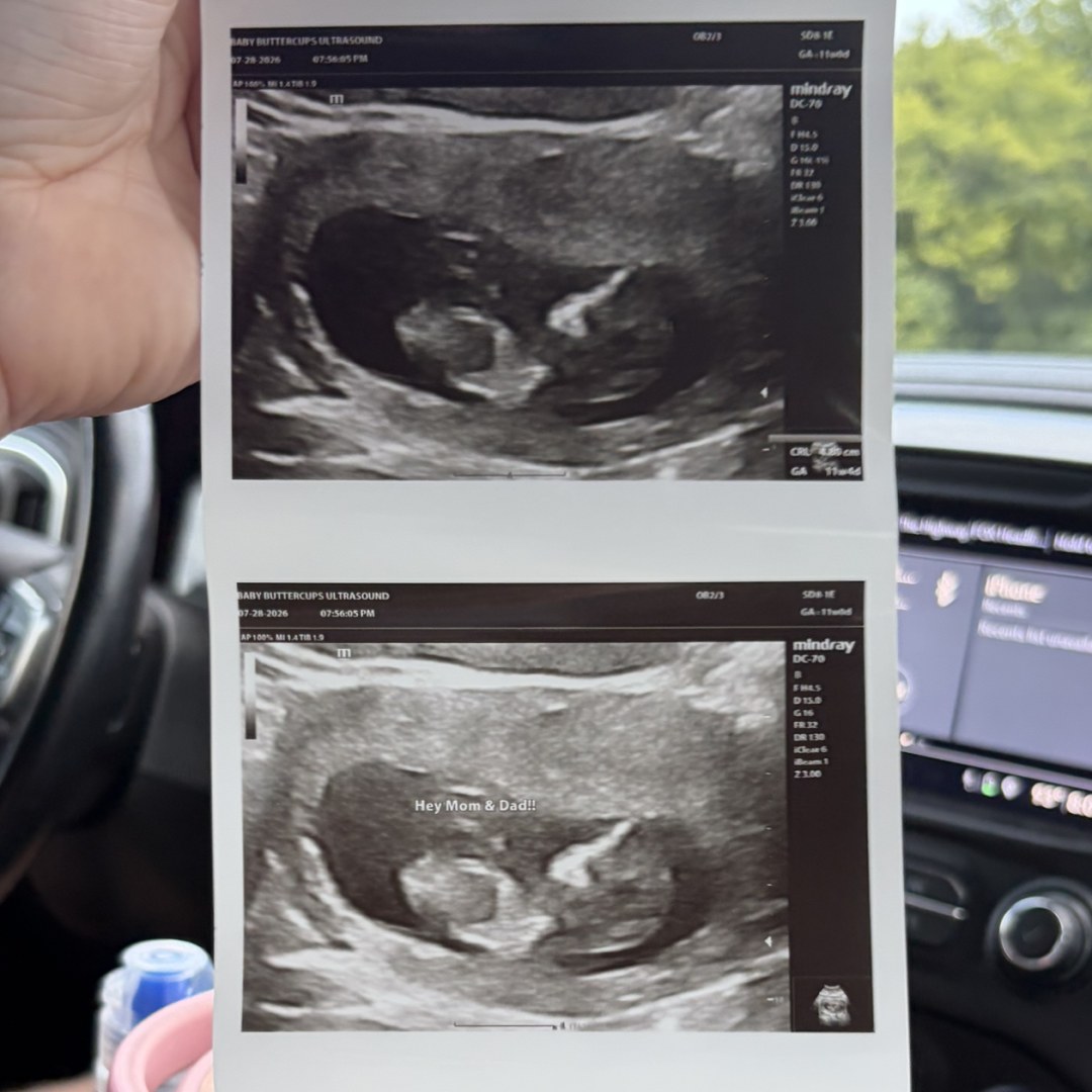 Photo shared by Shelby for their Babylist baby registry.