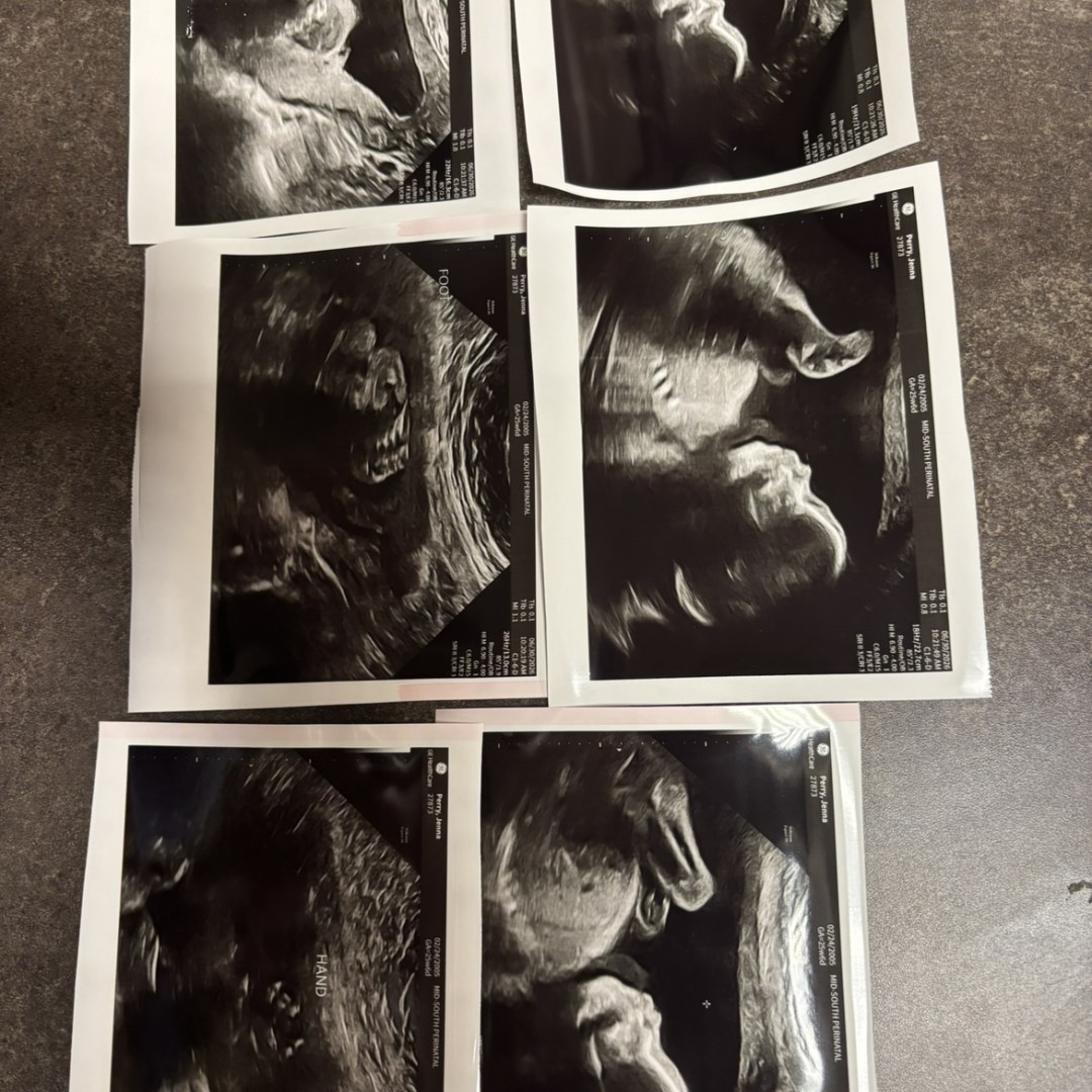 Photo shared by Jenna for their Babylist baby registry.