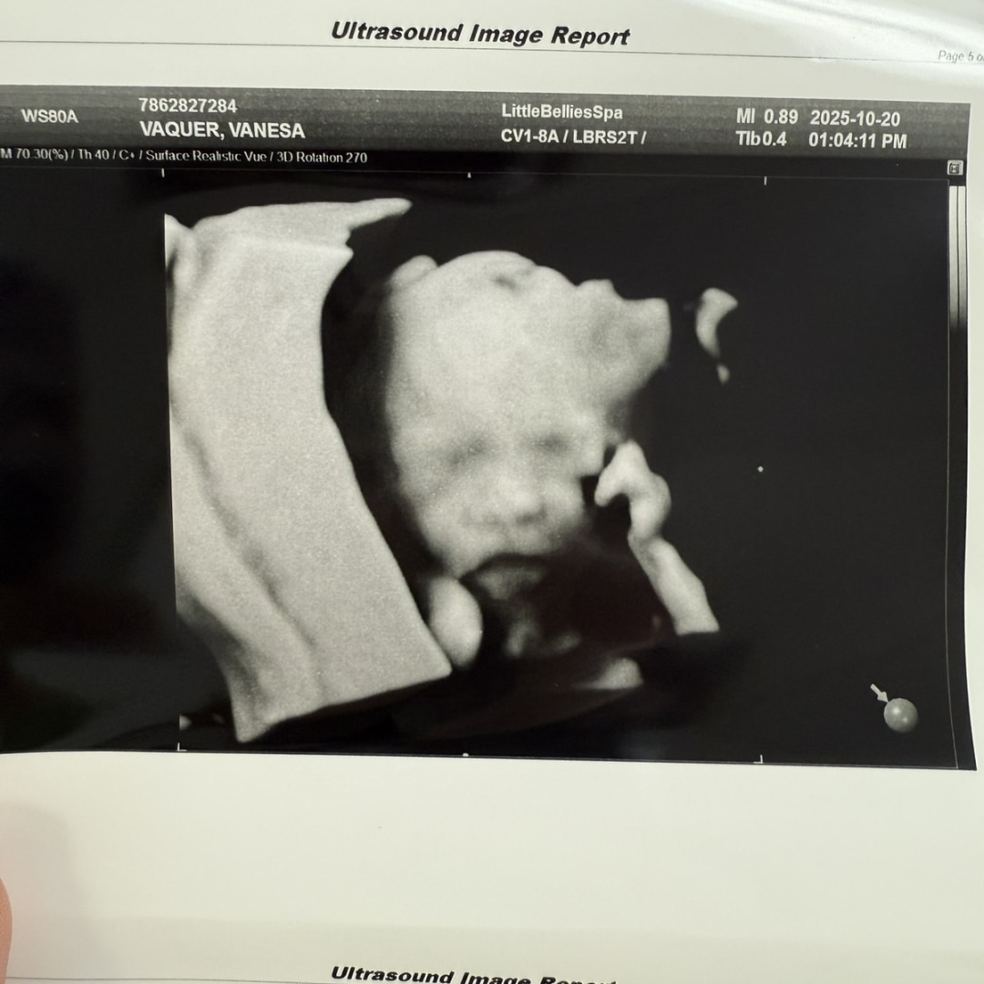 Photo shared by Chris for their Babylist baby registry.