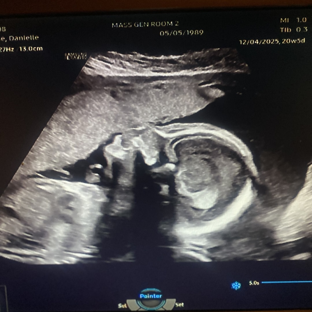 Photo shared by Danielle for their Babylist baby registry.