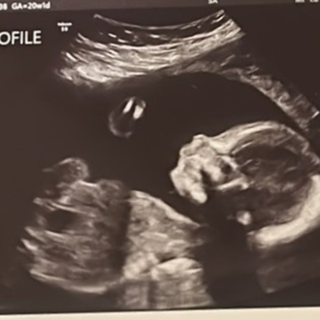 Photo shared by Alexandra for their Babylist baby registry.