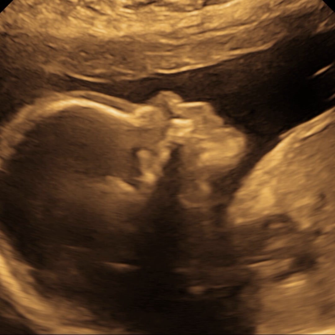 Photo shared by Andrea for their Babylist baby registry.