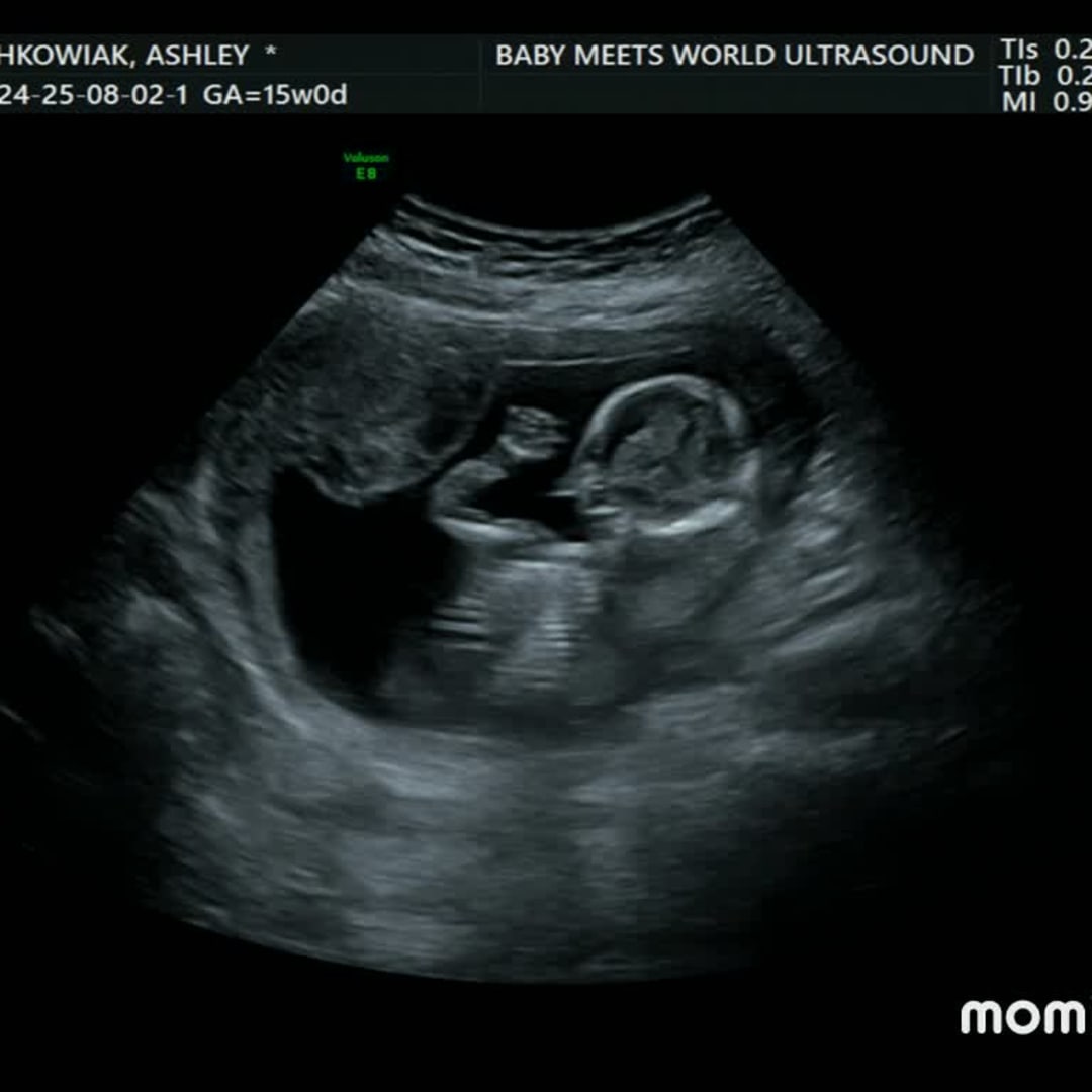 Photo shared by Ashley for their Babylist baby registry.