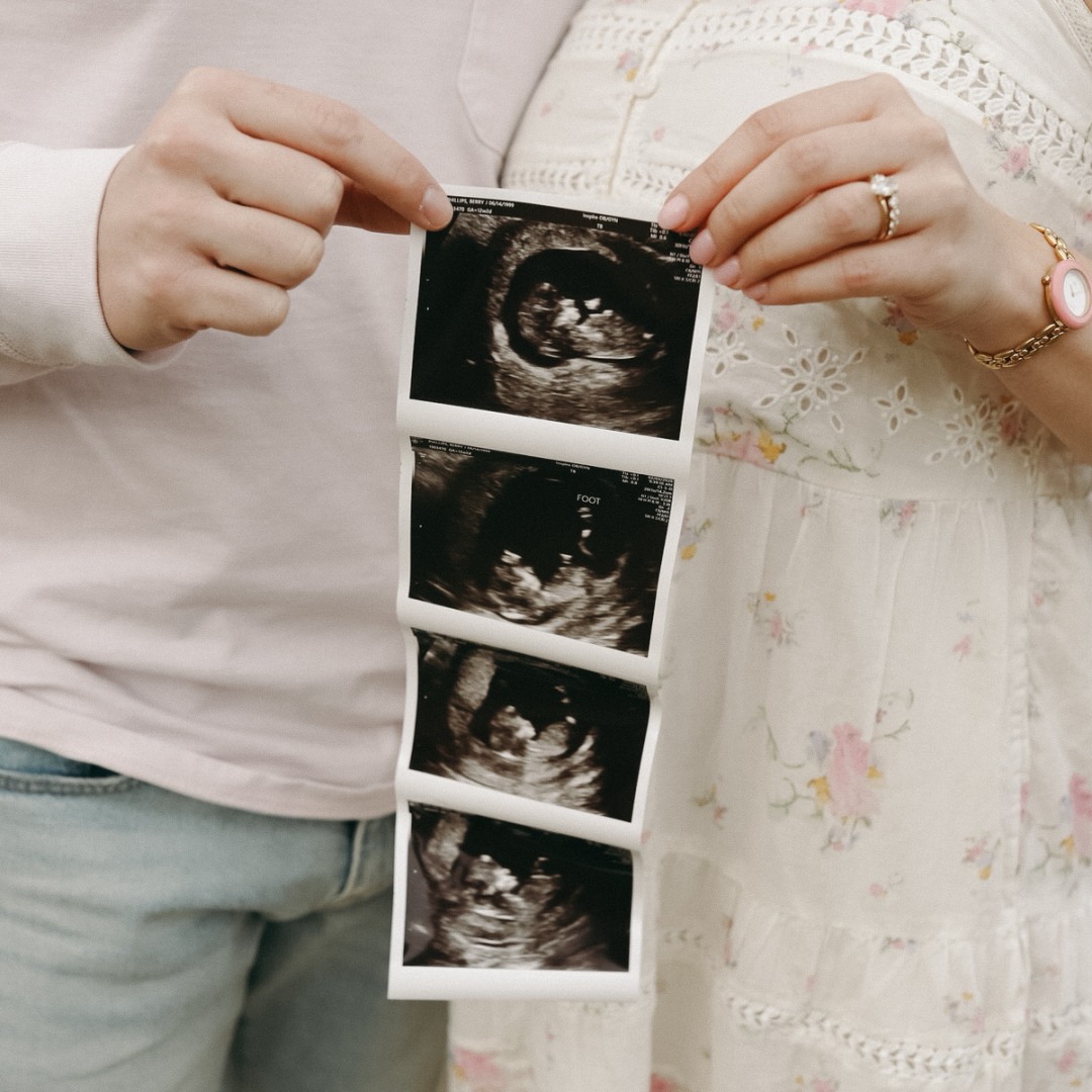 Photo shared by Berry for their Babylist baby registry.