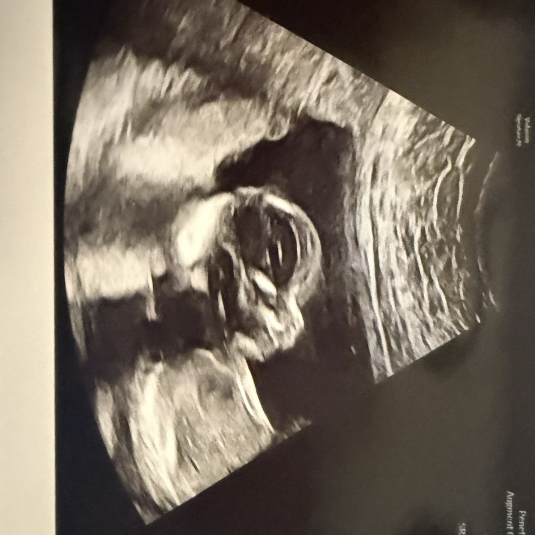 Photo shared by Alexis for their Babylist baby registry.