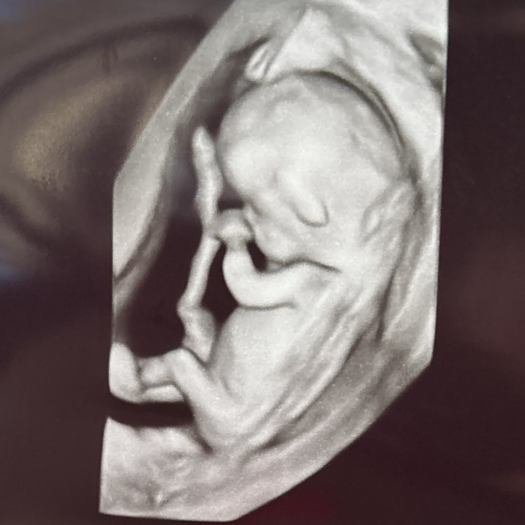 Photo shared by Erin for their Babylist baby registry.