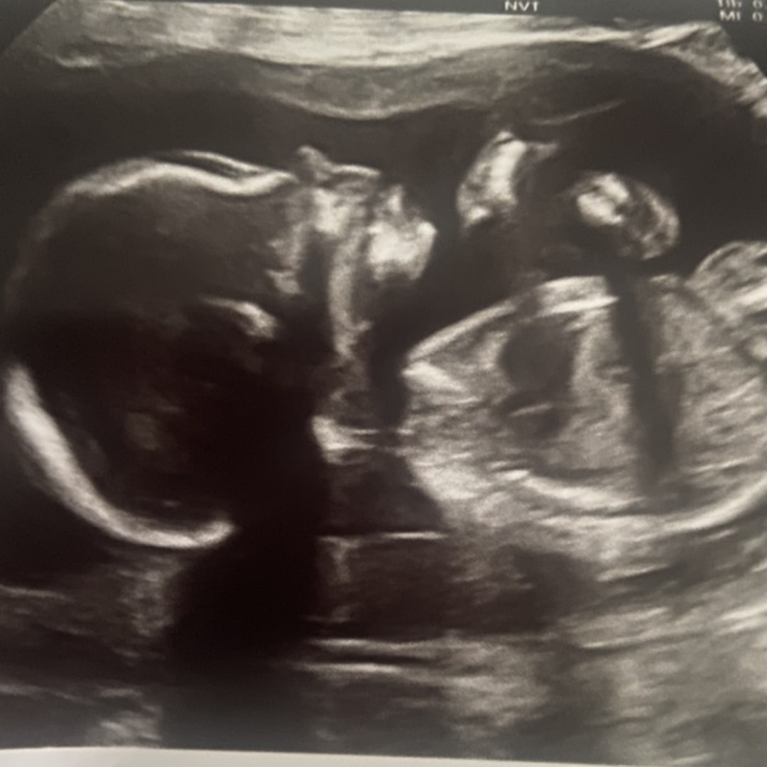Photo shared by Ceara for their Babylist baby registry.