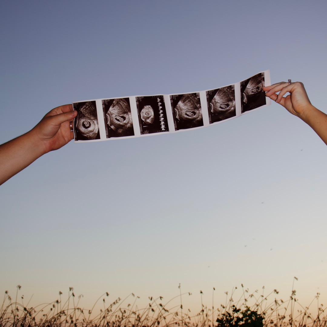 Photo shared by Emily for their Babylist baby registry.