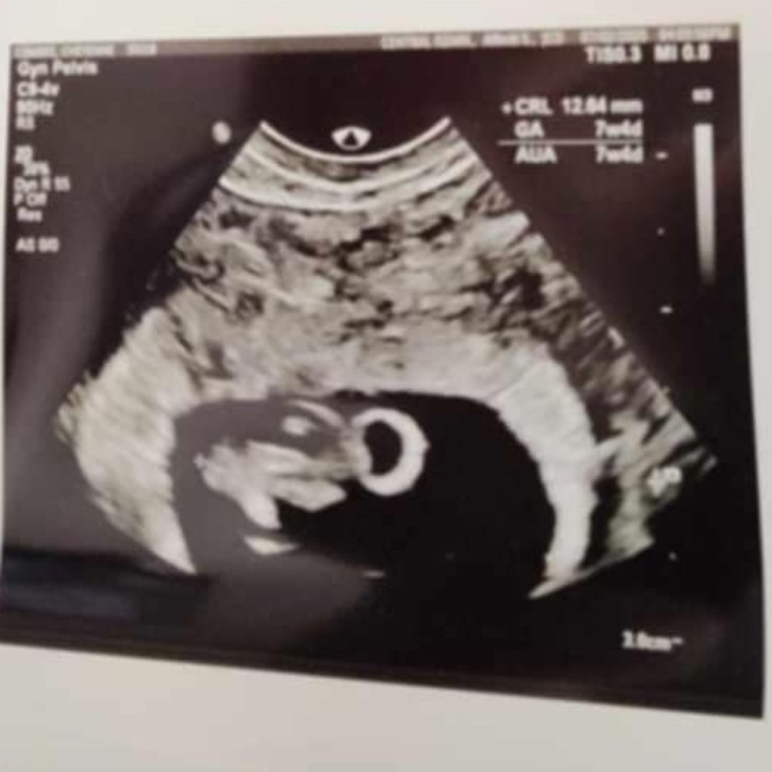 Photo shared by Cheyenne for their Babylist baby registry.