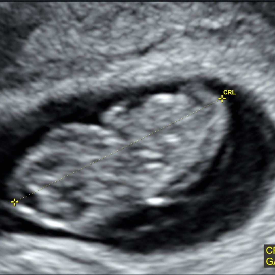 Photo shared by Laurel for their Babylist baby registry.