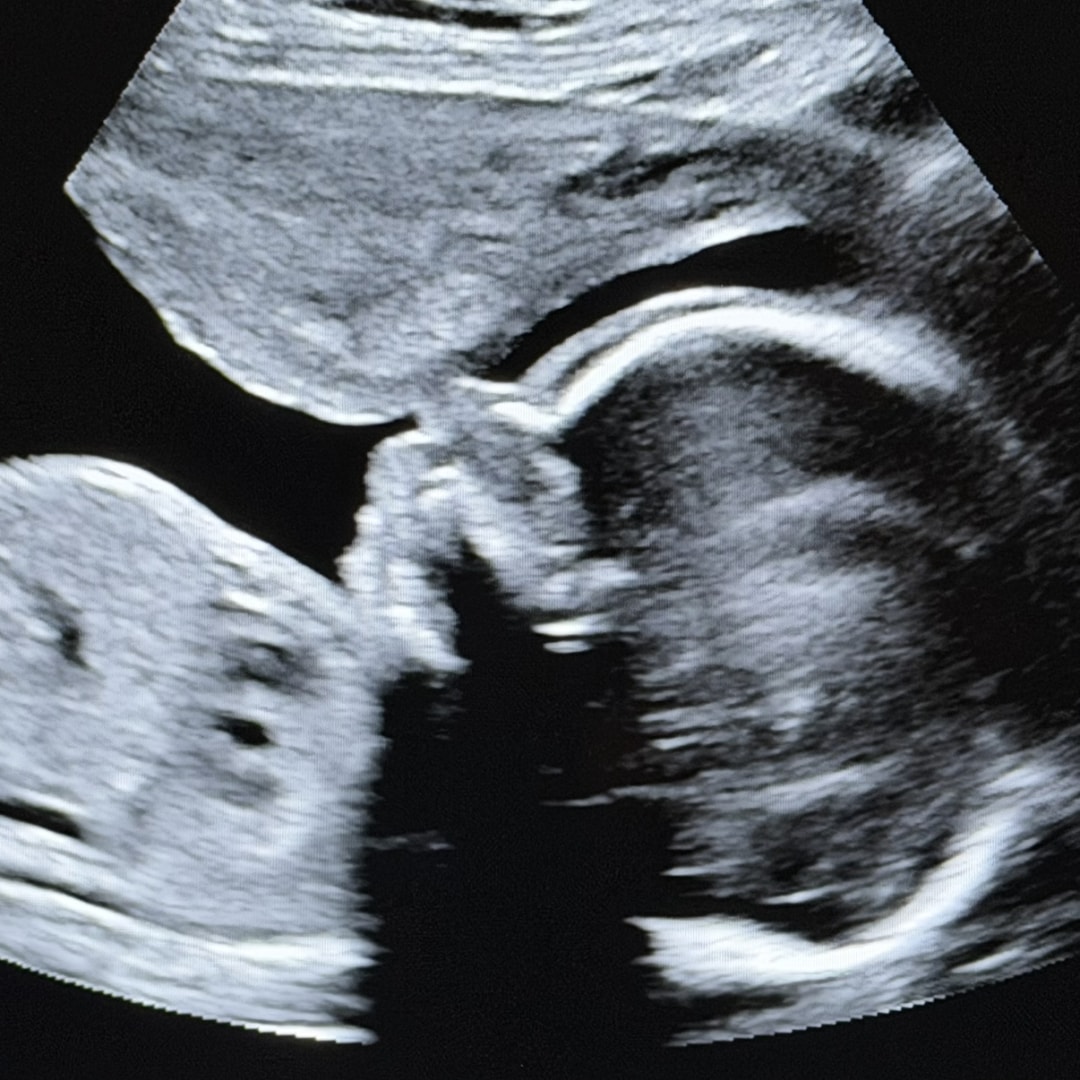 Photo shared by Wendi for their Babylist baby registry.