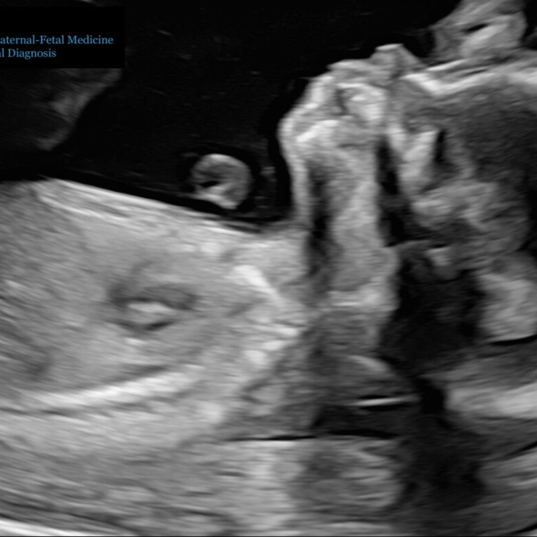 Photo shared by Lindsay for their Babylist baby registry.