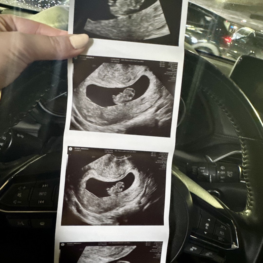 Photo shared by Mikayla for their Babylist baby registry.
