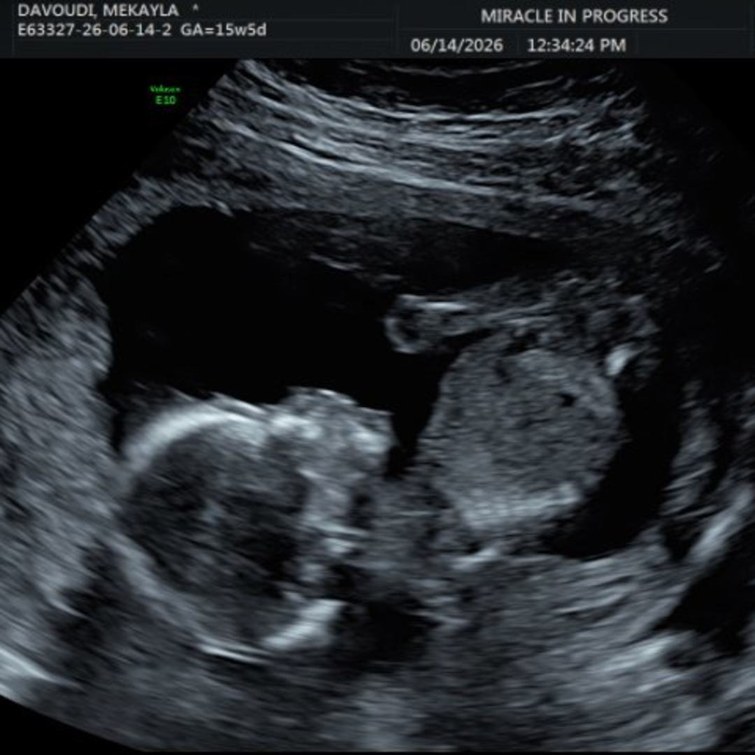 Photo shared by Mekayla for their Babylist baby registry.