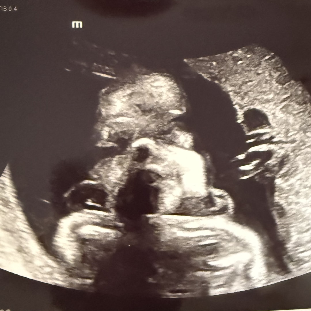 Photo shared by Sabrina for their Babylist baby registry.