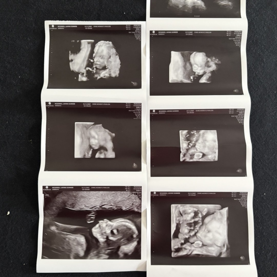 Photo shared by Summer for their Babylist baby registry.