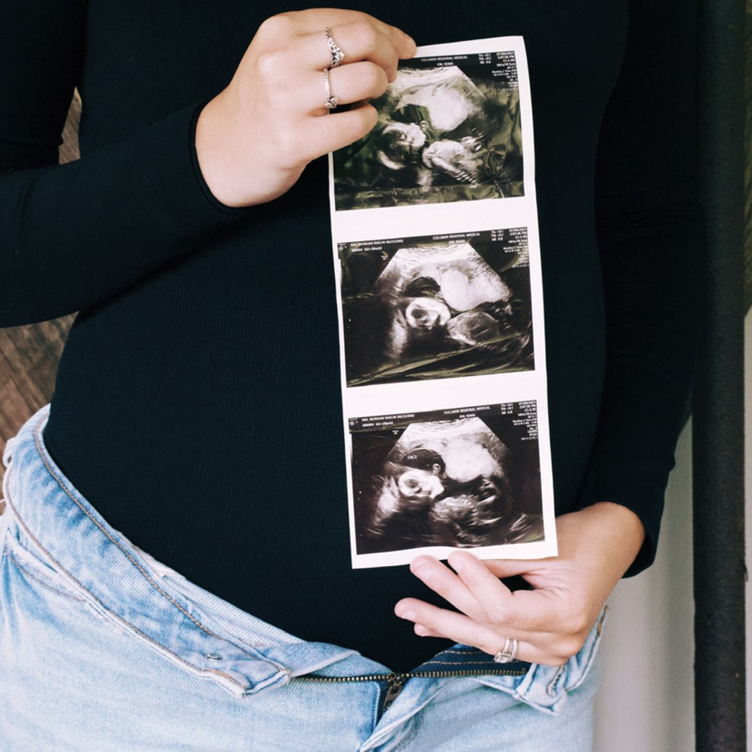 Photo shared by Morgan for their Babylist baby registry.