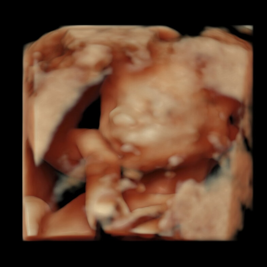 Photo shared by Devin for their Babylist baby registry.