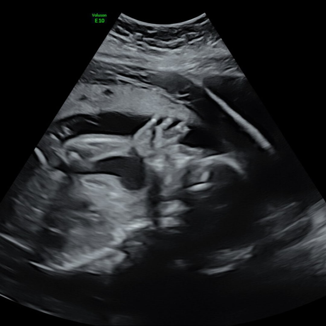 Photo shared by Carmen for their Babylist baby registry.